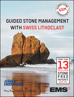GUIDED STONE MANAGEMENT WITH SWISS LITHOCLAST