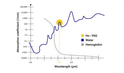 Laser-Absorption&Tissue-Penetration